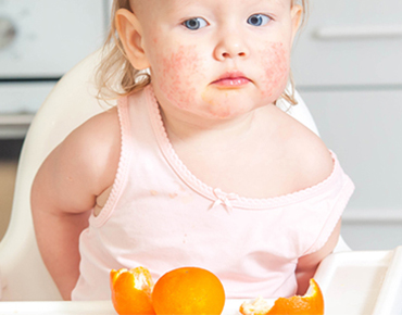 Identifying Common Food Allergies in Children